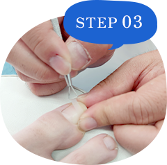 STEP03.プレート装着